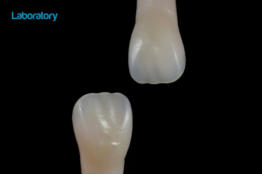 Tooth layers: essential features and their impact on dental restorations
