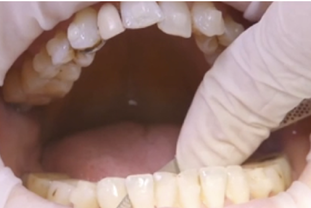 Aligner Dental Academy 2025: master Invisalign with a year of insights