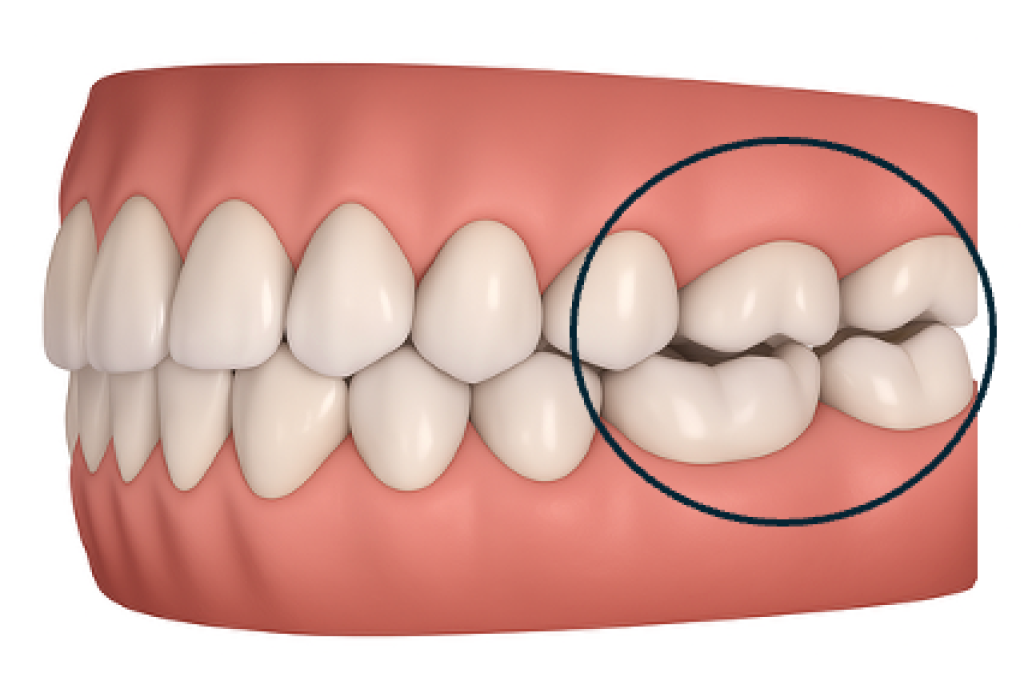 Aligner Dental Academy 2025: master Invisalign with a year of insights