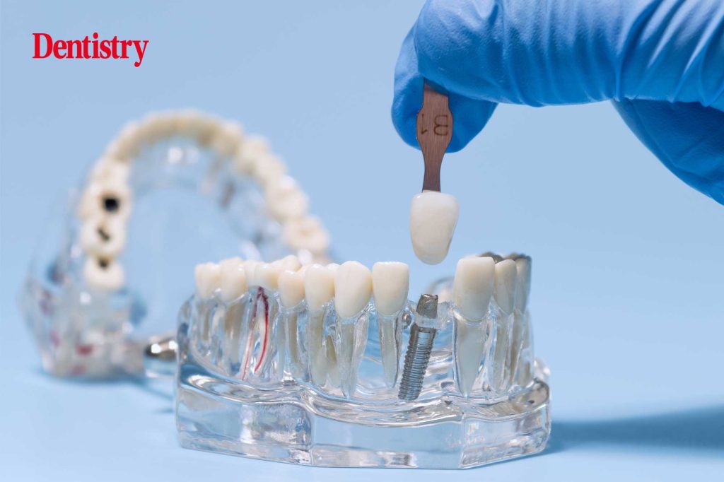 Management of dental implant complications and how to avoid them
