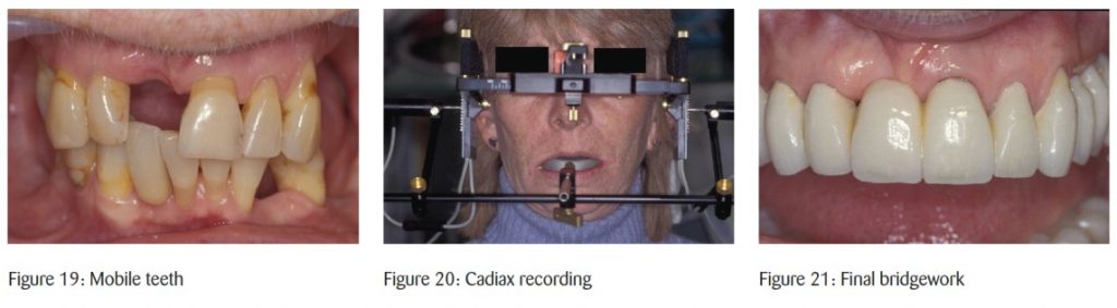Full-mouth reconstruction in modern practice: timeless principles from one of the UK’s top clinicians