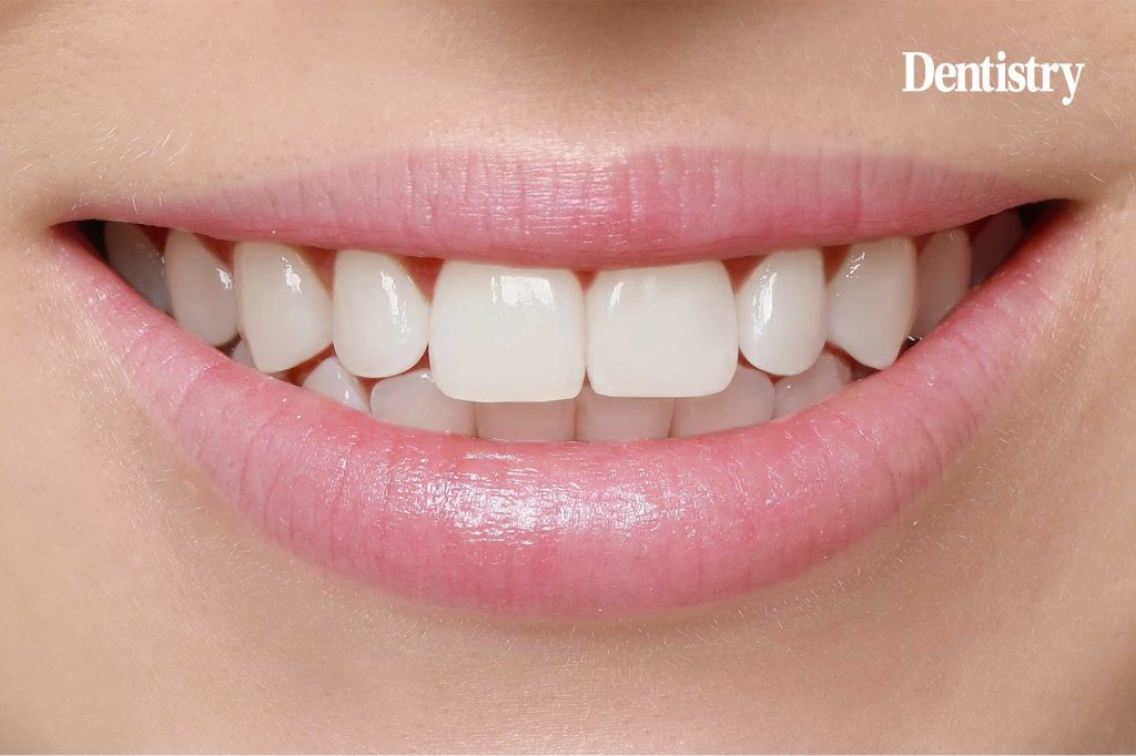 How to imitate natural teeth with composite resin
