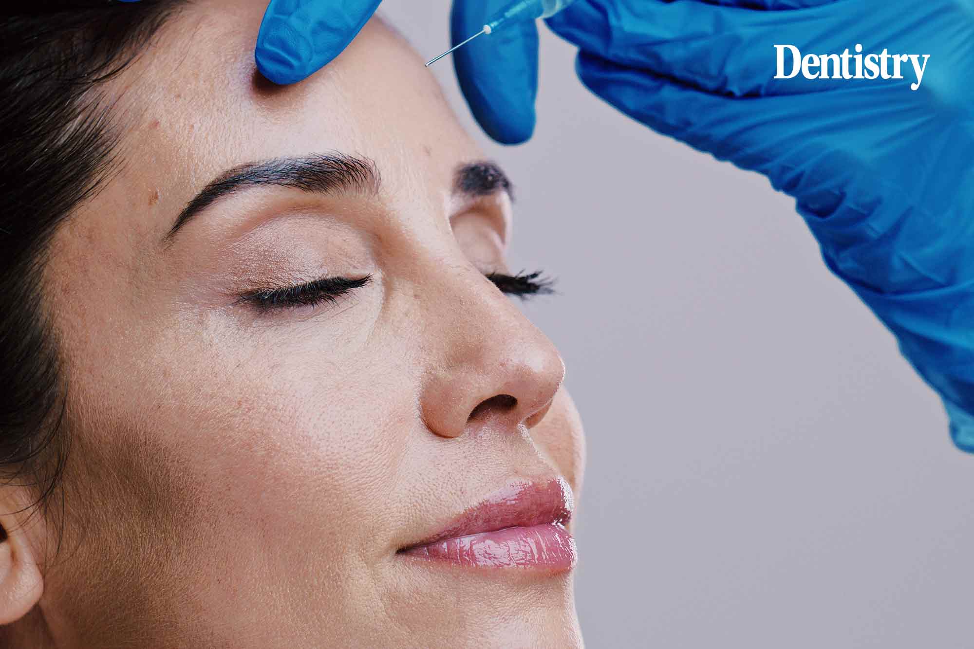 Ultrasound can improve treatment of vascular complications from cosmetic fillers