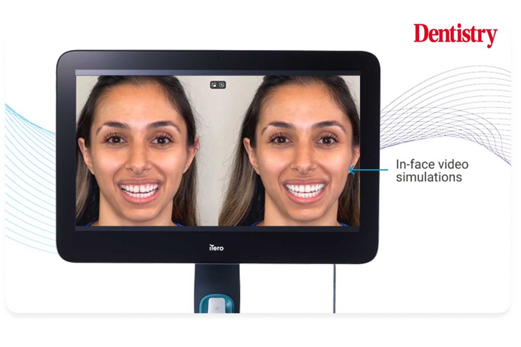 Helping patients understand and accept their treatment options by building emotional engagement