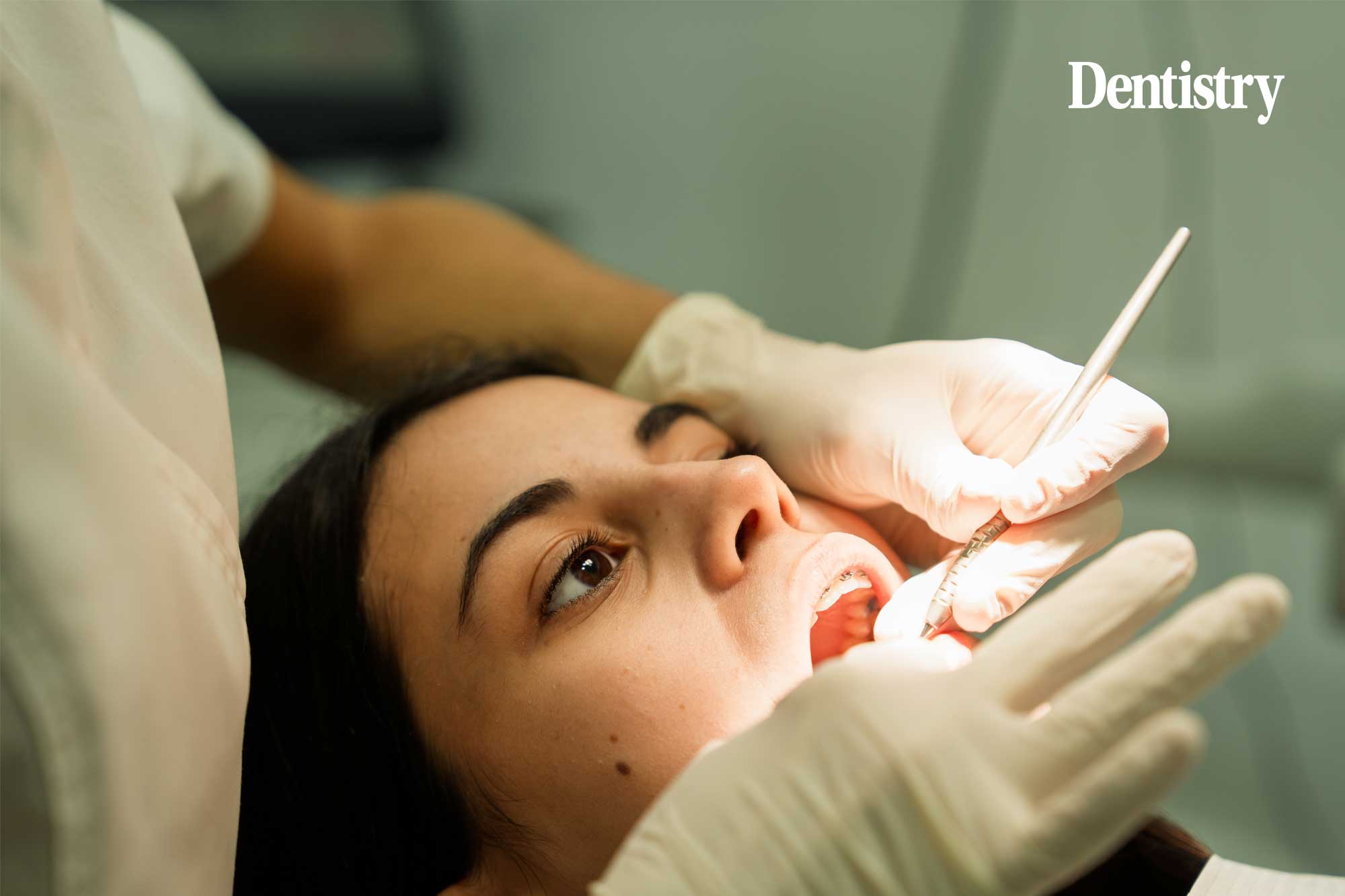 Care leavers to receive extended access to free NHS dentistry