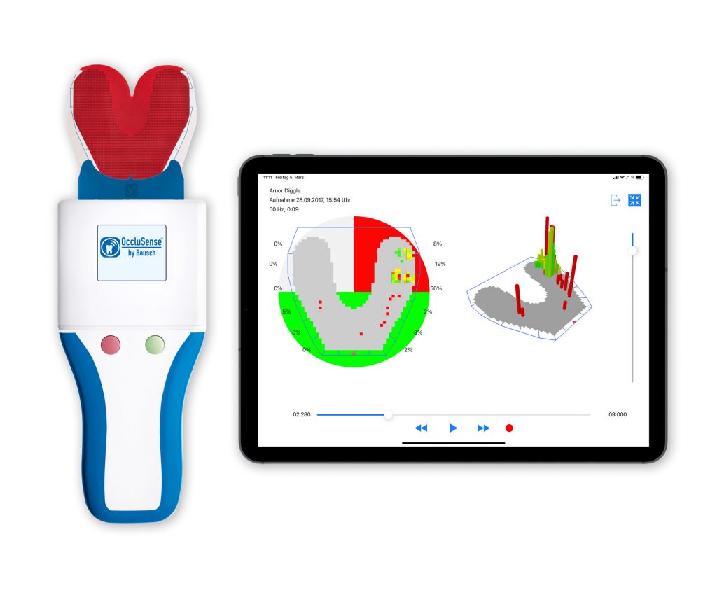 Digital occlusion analysis in adhesive rehabilitation of tooth wear patients