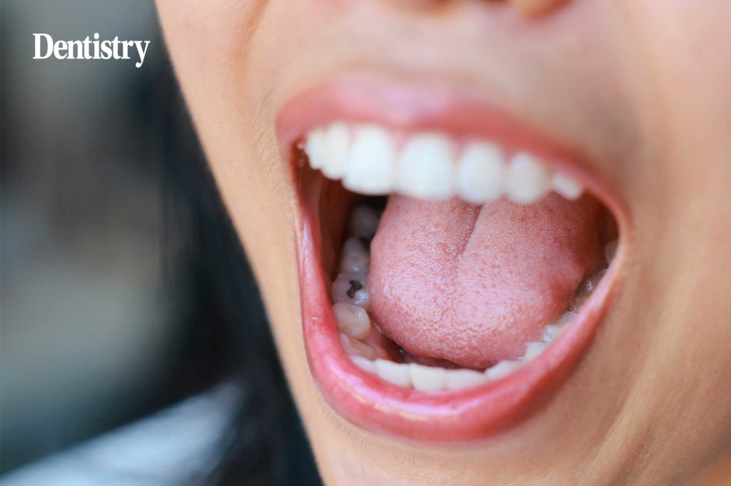 Amalgam ban: is the risk to practices bigger than the risk to patients?