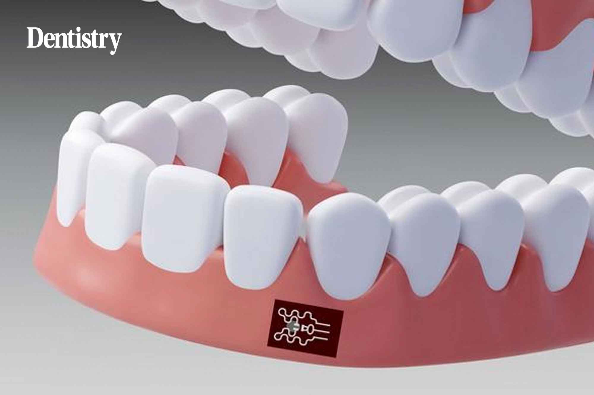 Wearable biosensor developed to detect gum disease