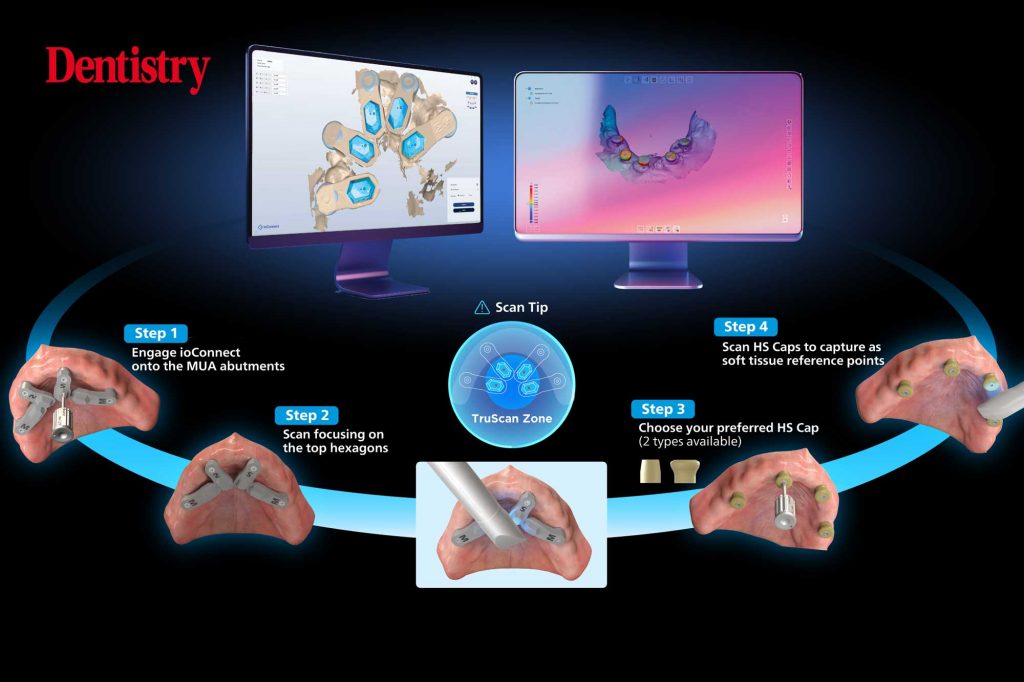 Full-arch made simple: transform all-on-X scanning with TRIOS ioConnect