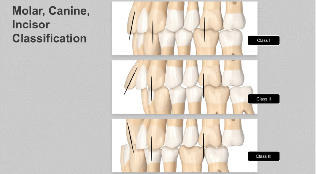 A comprehensive orthodontic assessment – the SAFE way