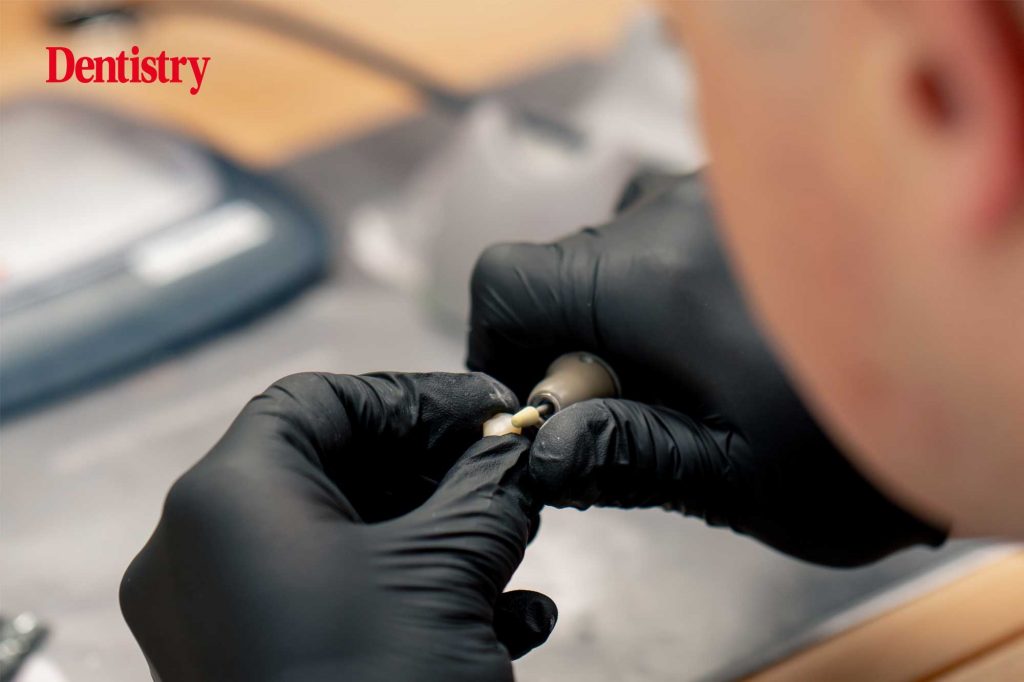 Why I choose Avant Garde Lab – a personal perspective