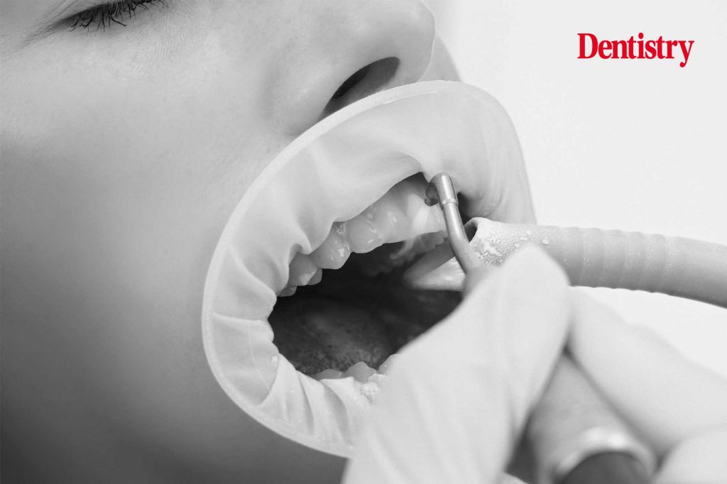 Treatment of periodontitis and minimally invasive treatment with modern technology