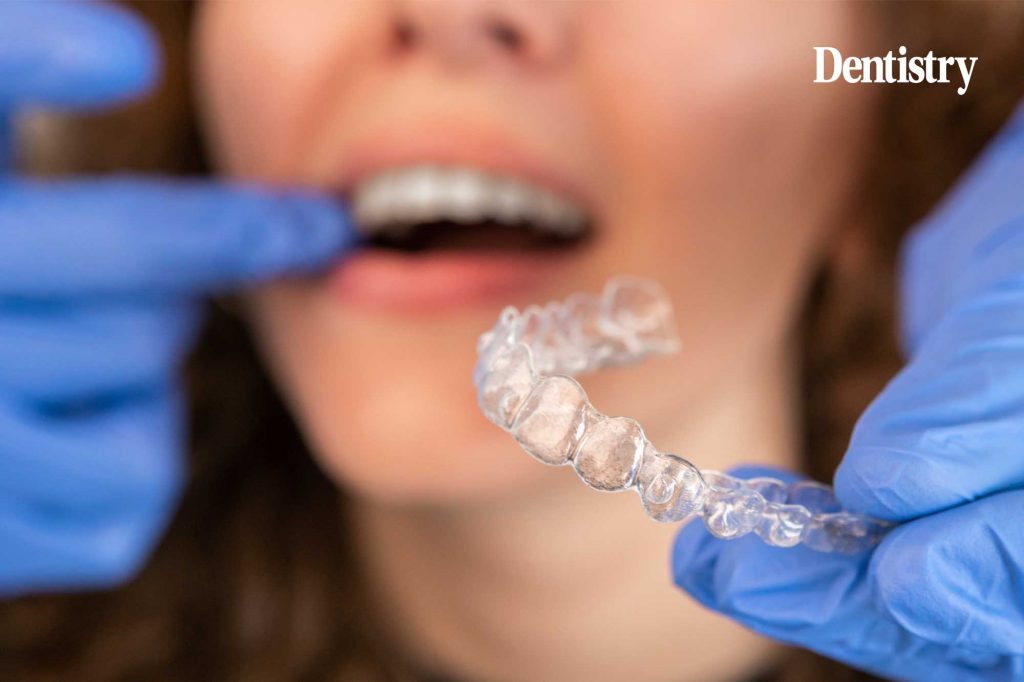 Why dentists are seeking treatment planning support for Invisalign cases