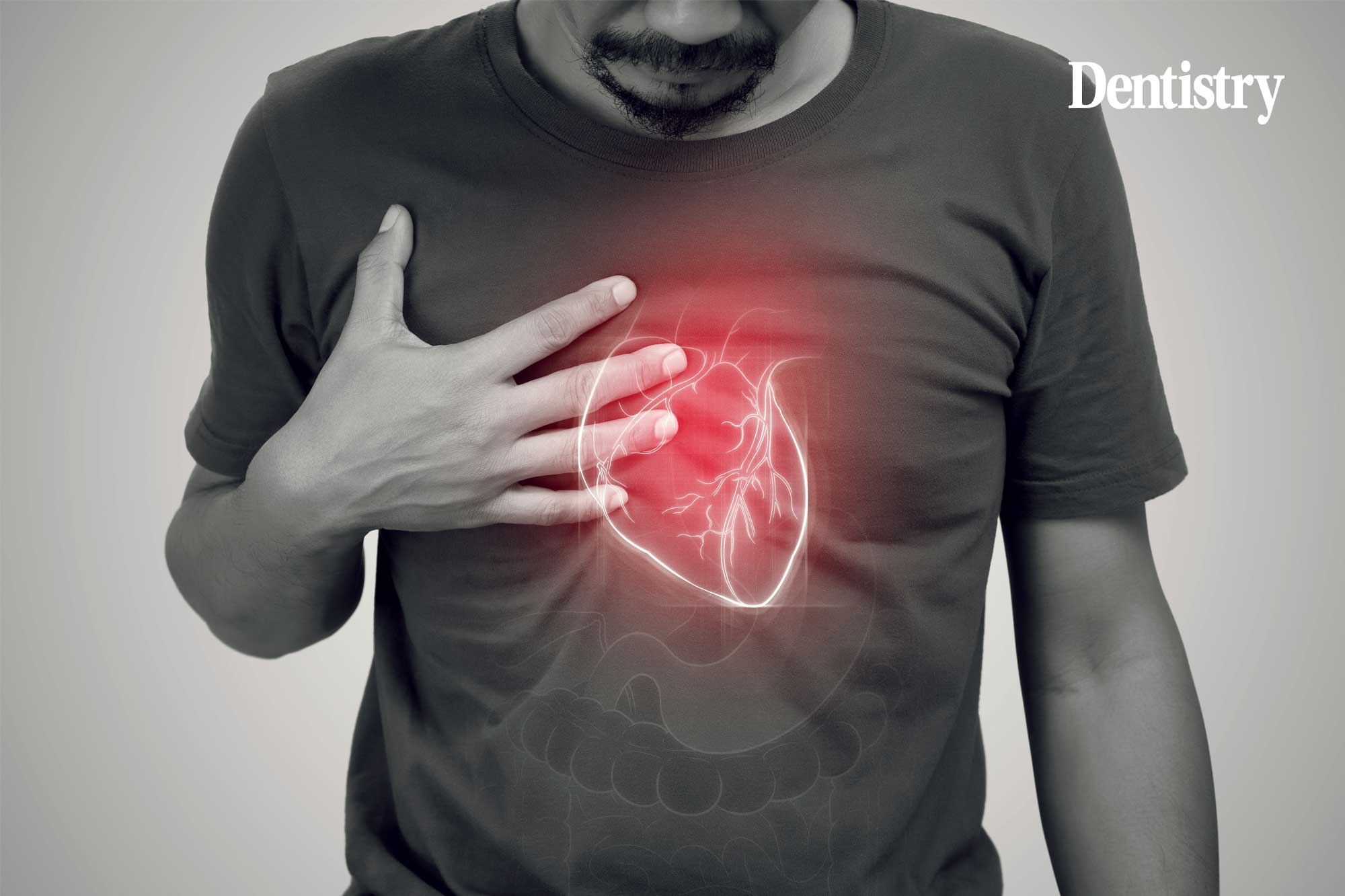 A major NICE update: why infective endocarditis prevention is back on the agenda