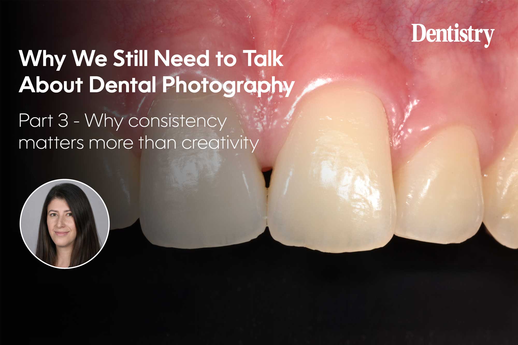 Standardisation in dental photography: consistency over creativity