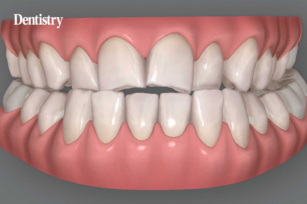 Complex treatment planning: a collaborative approach to predictability