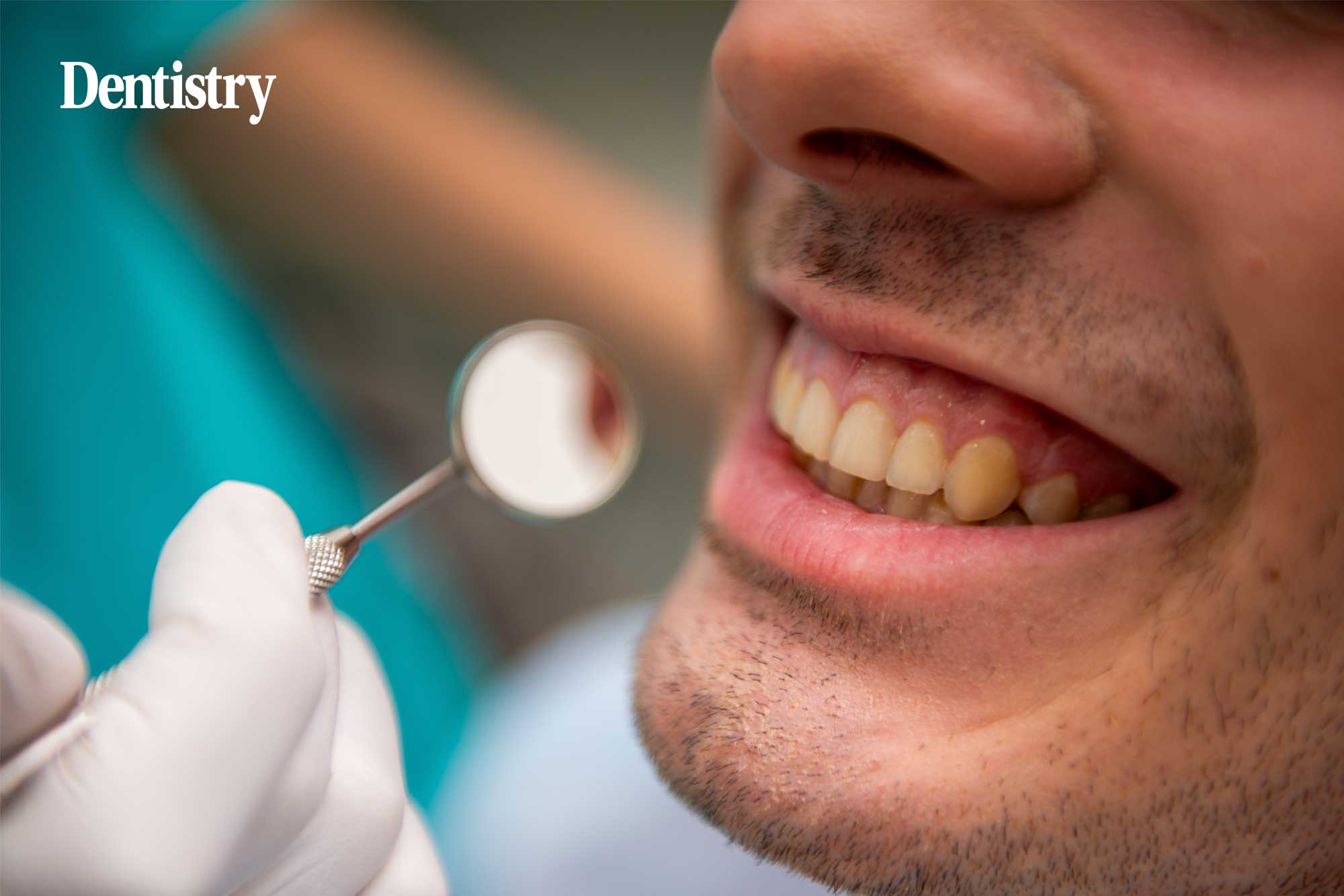 Embedding early intervention in gingival health