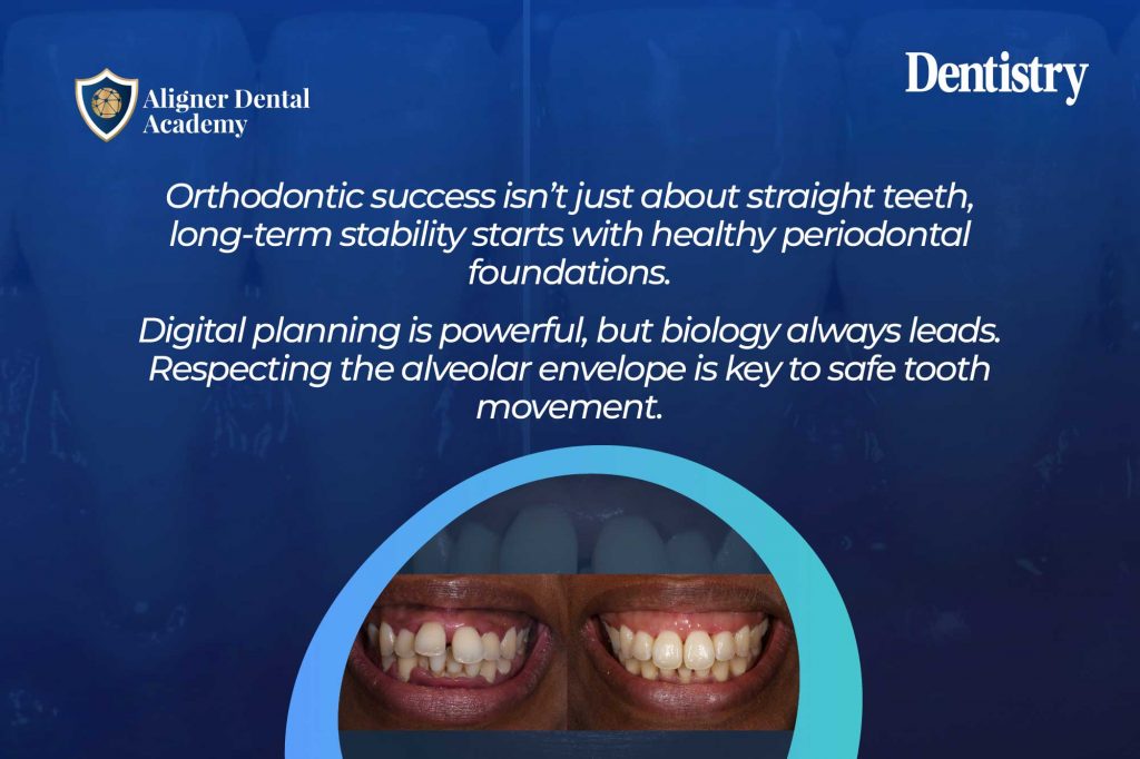 The interdependence of periodontal health and orthodontic tooth movement