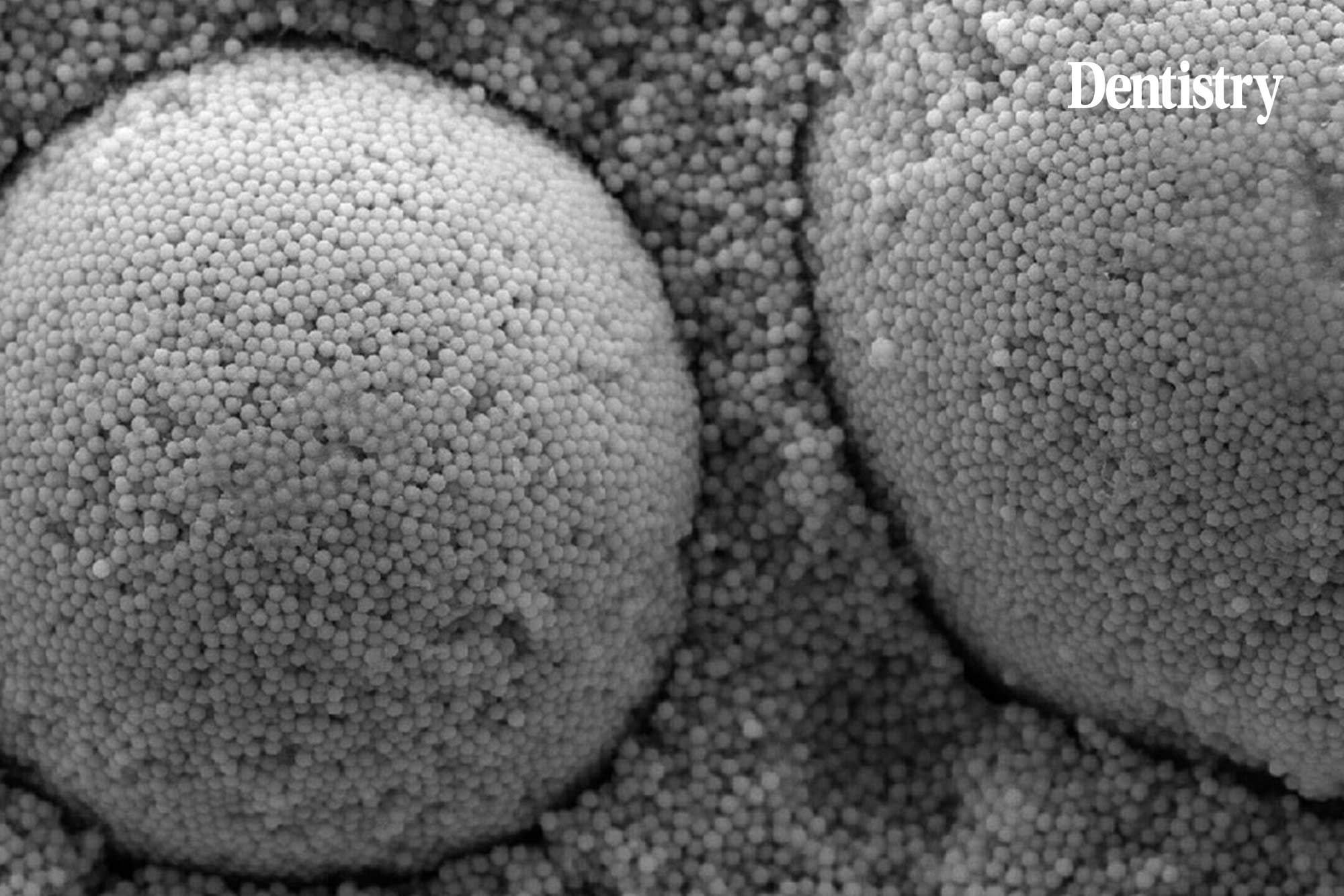Shade matching in composites: metal oxides or structure?