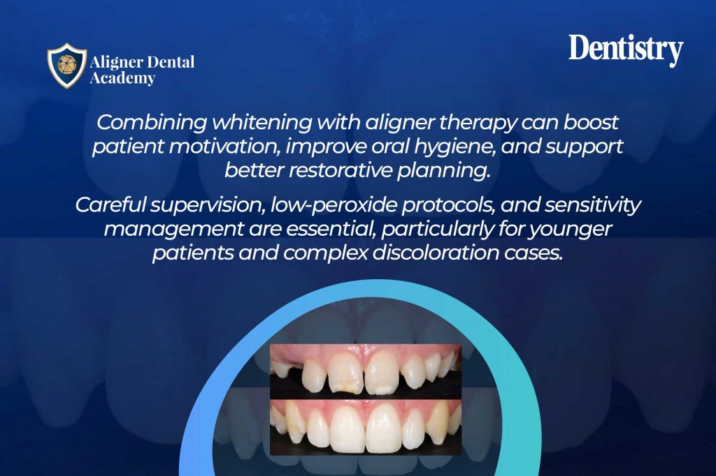 Whitening during Invisalign treatment: a modern approach to aesthetic dentistry