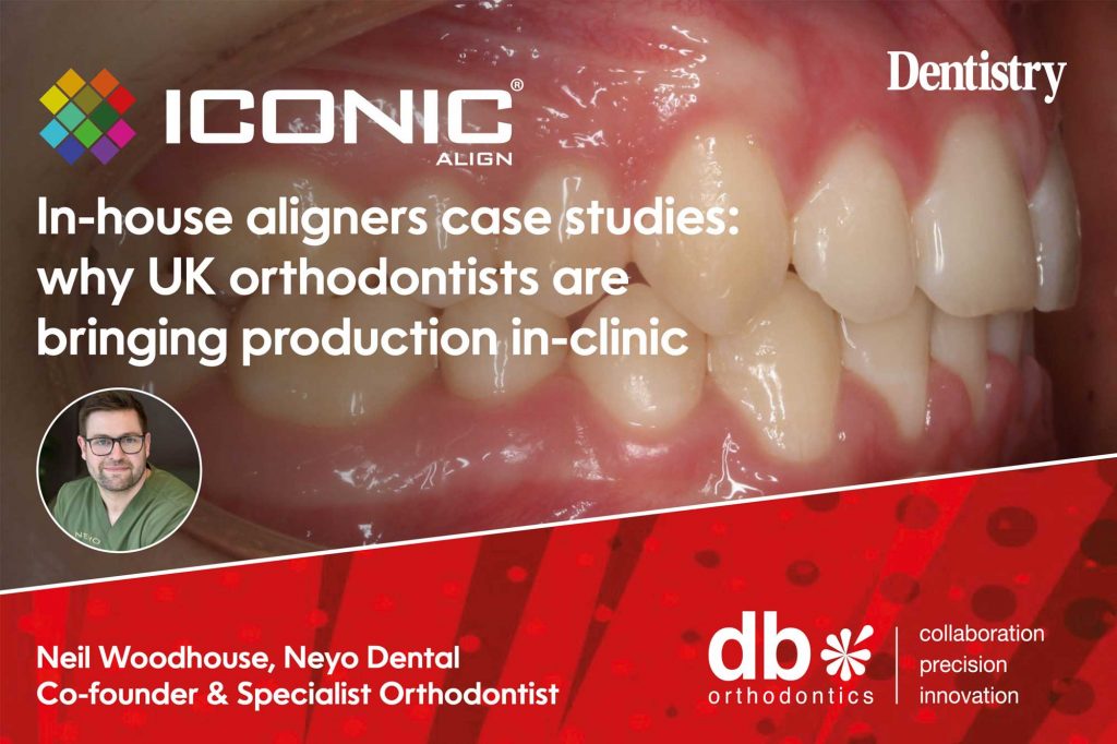 Why more UK orthodontists are bringing aligner production in-house