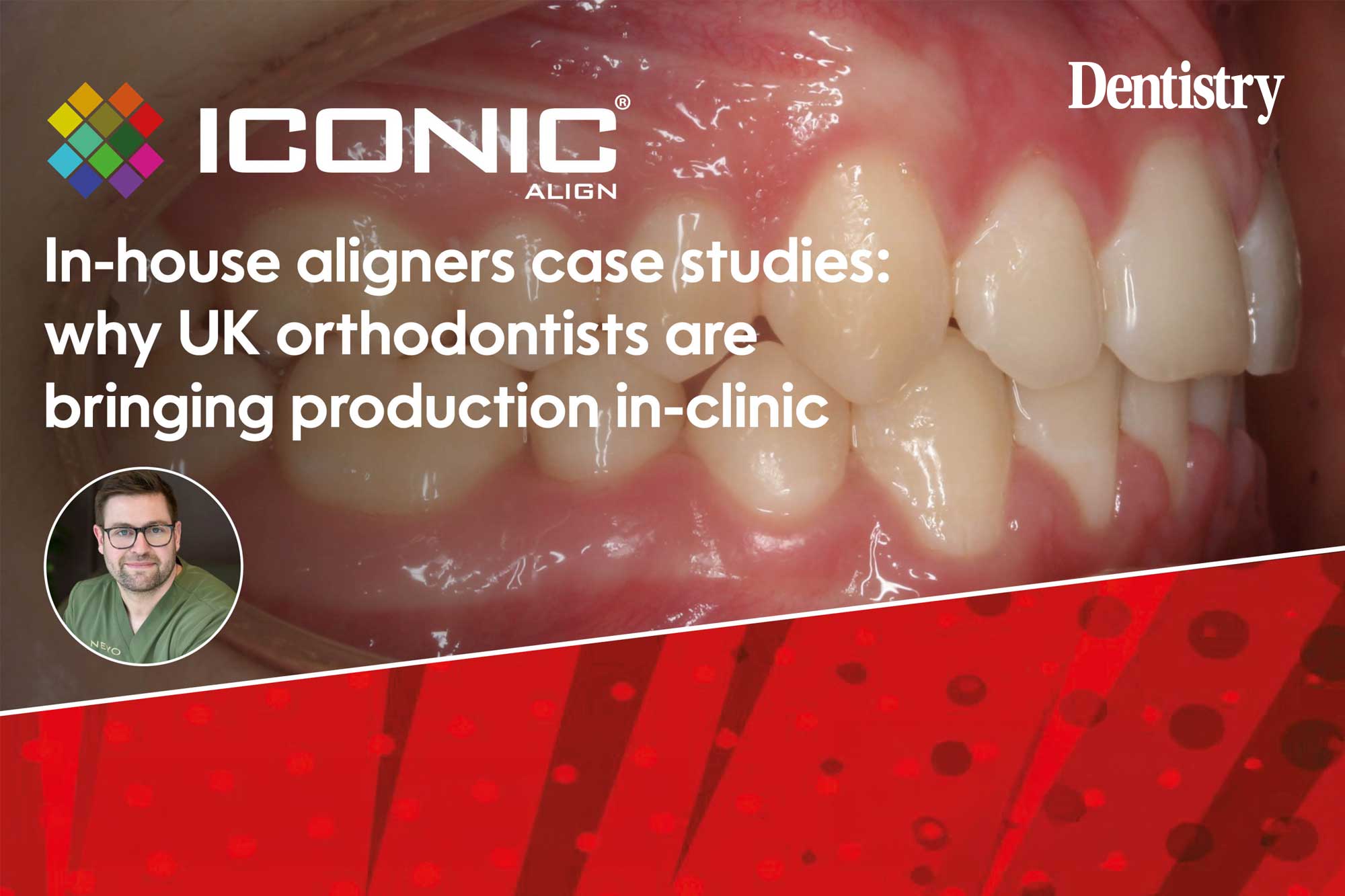 Why more UK orthodontists are bringing aligner production in-house