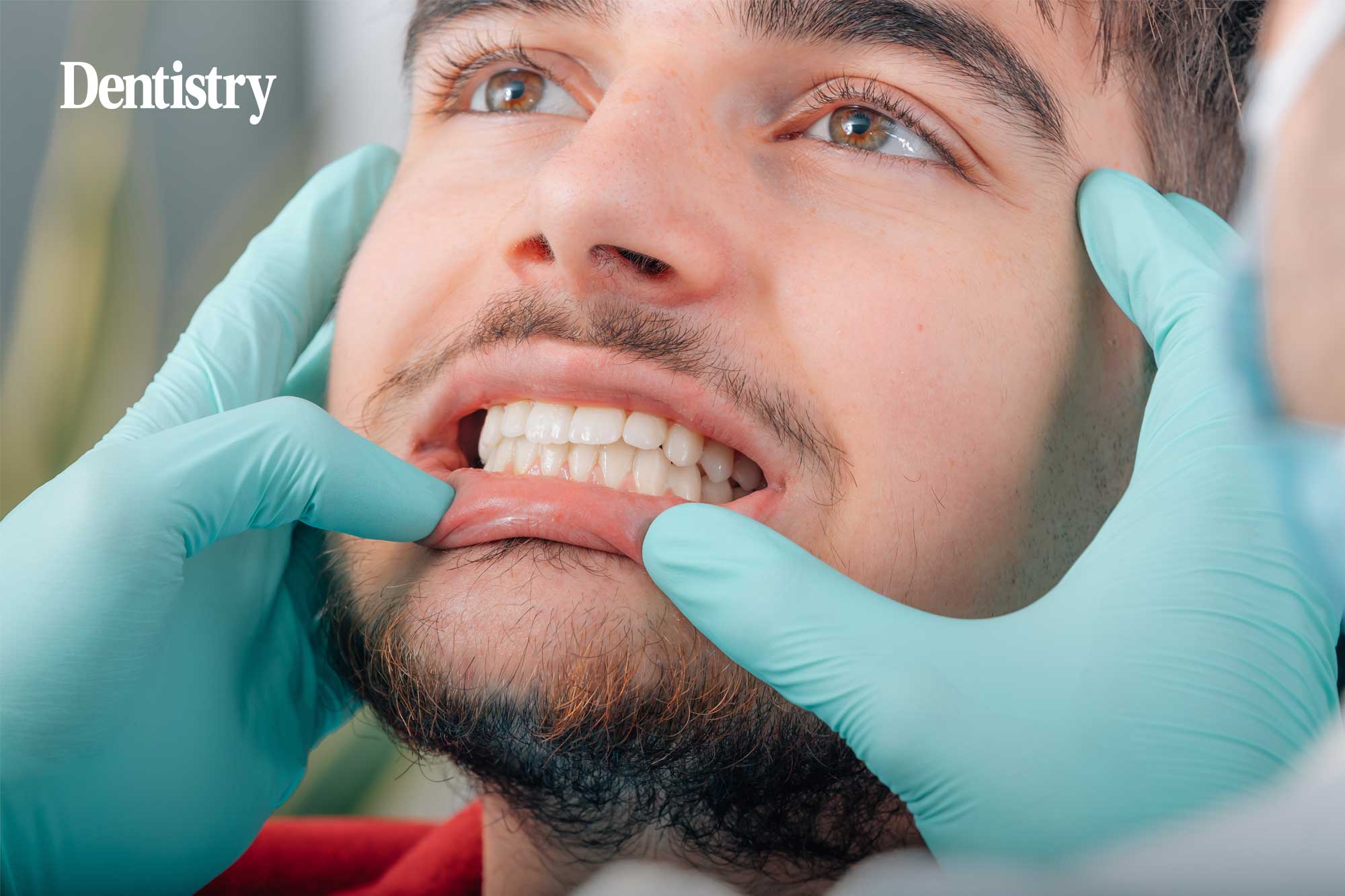 The cost of missed periodontitis: lessons from negligence claims