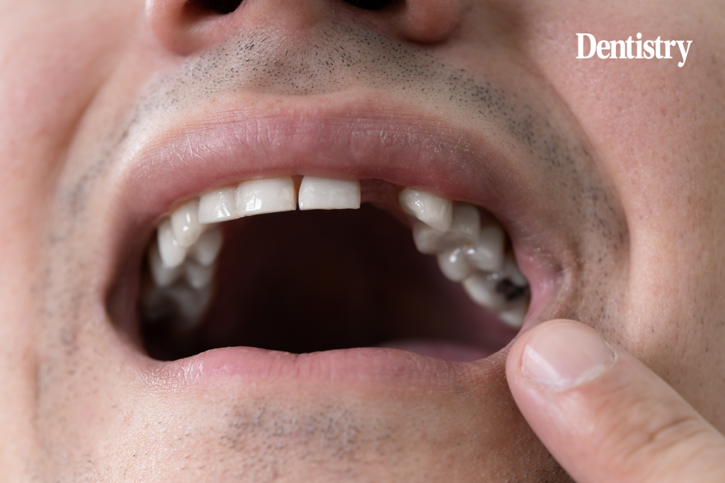 Toregem secures Kyoto support as it advances tooth regeneration ambitions