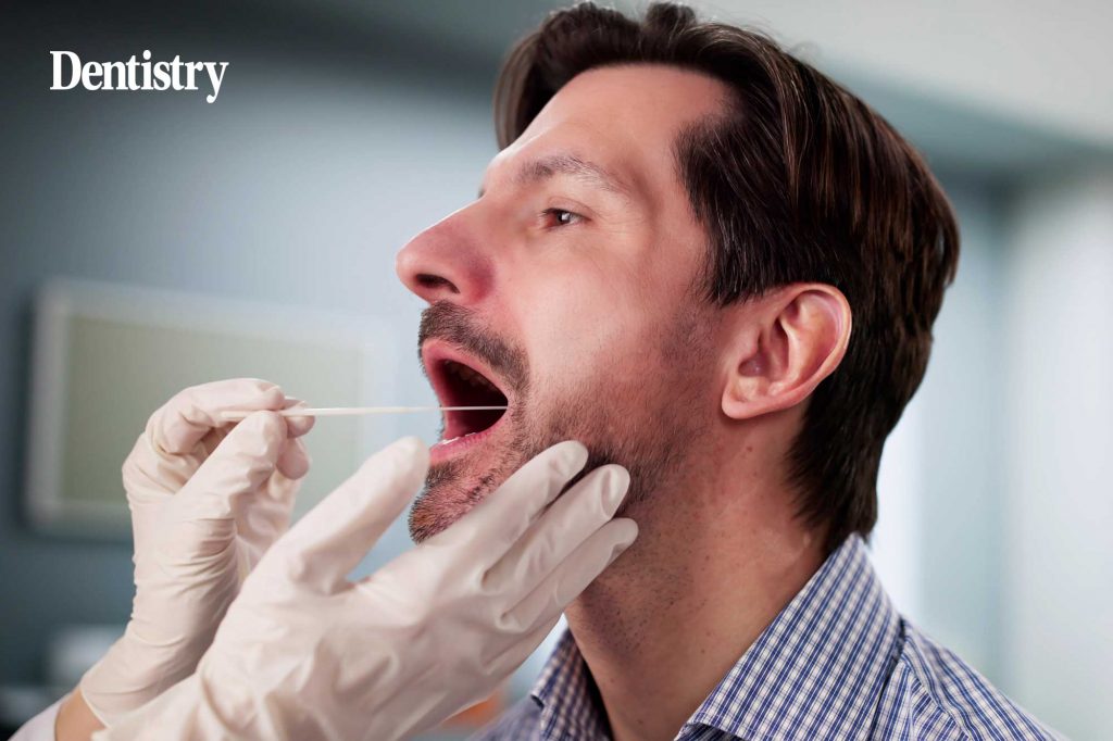 New brush biopsy could detect mouth cancer in under one hour