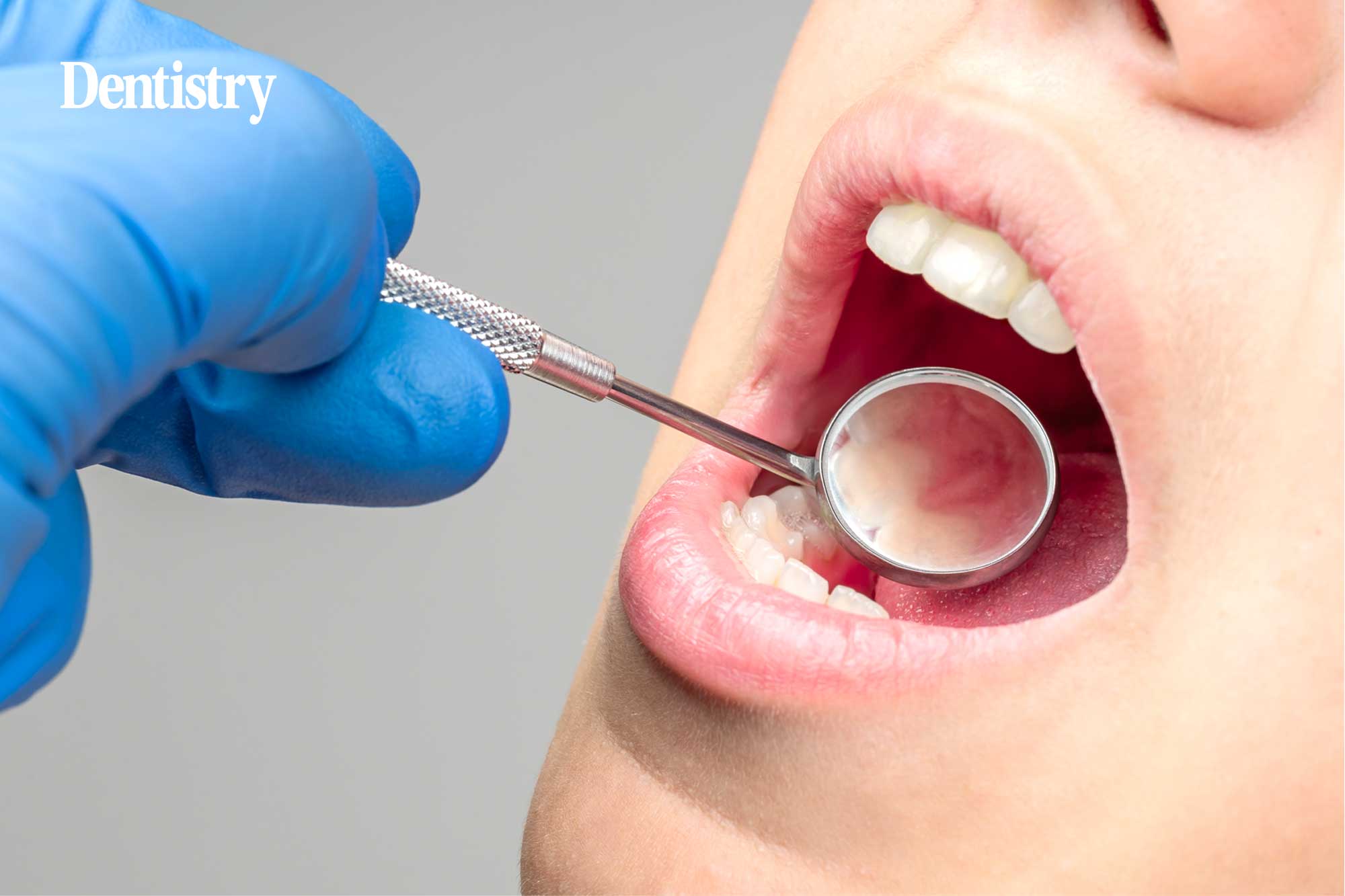 Periodontitis outcomes: consensus, collaboration and co-operation