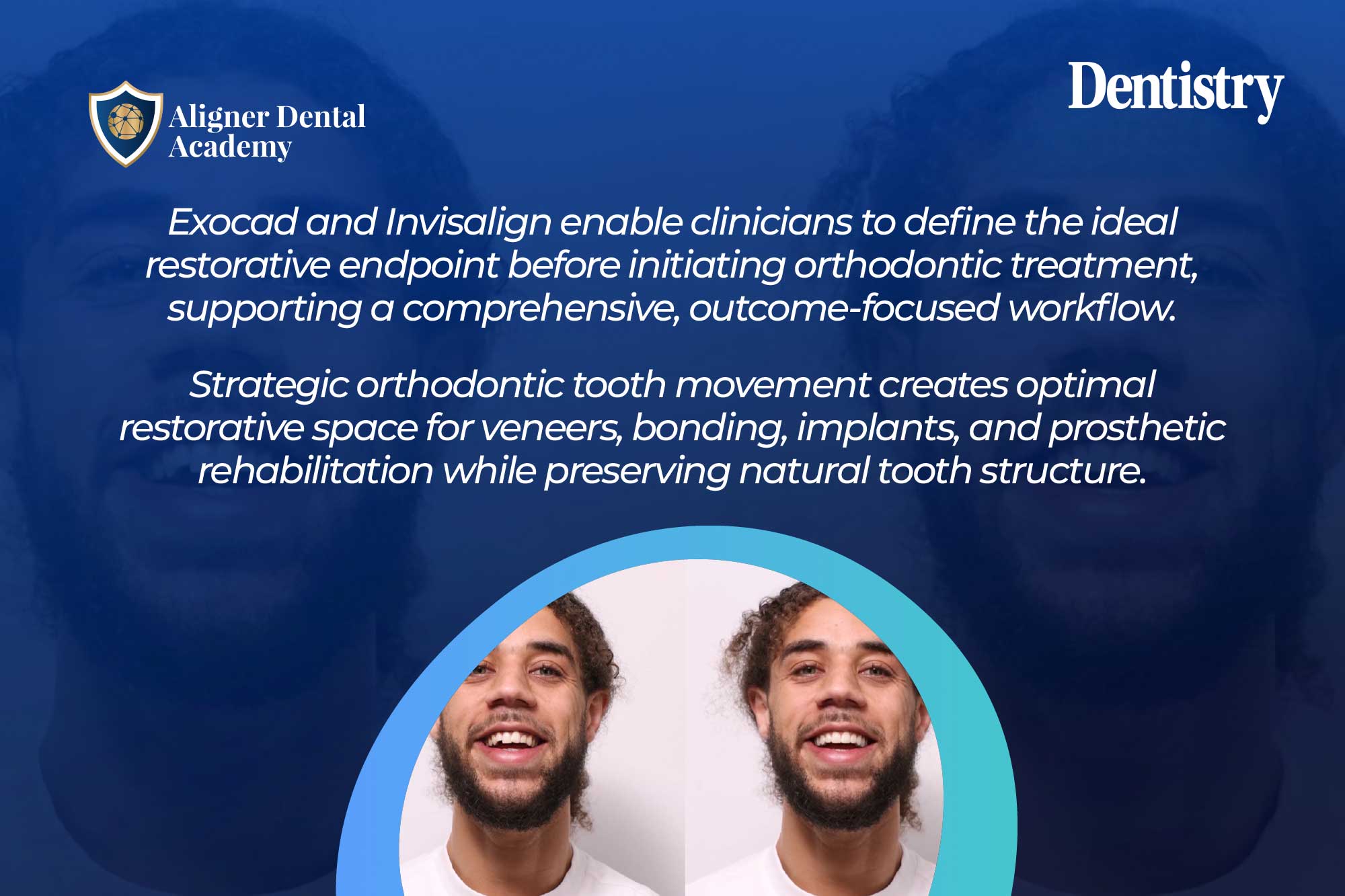 Ortho-restorative dentistry: exocad in the Invisalign workflow