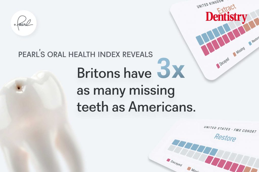 Oral Health Index reveals differences between UK and US oral health
