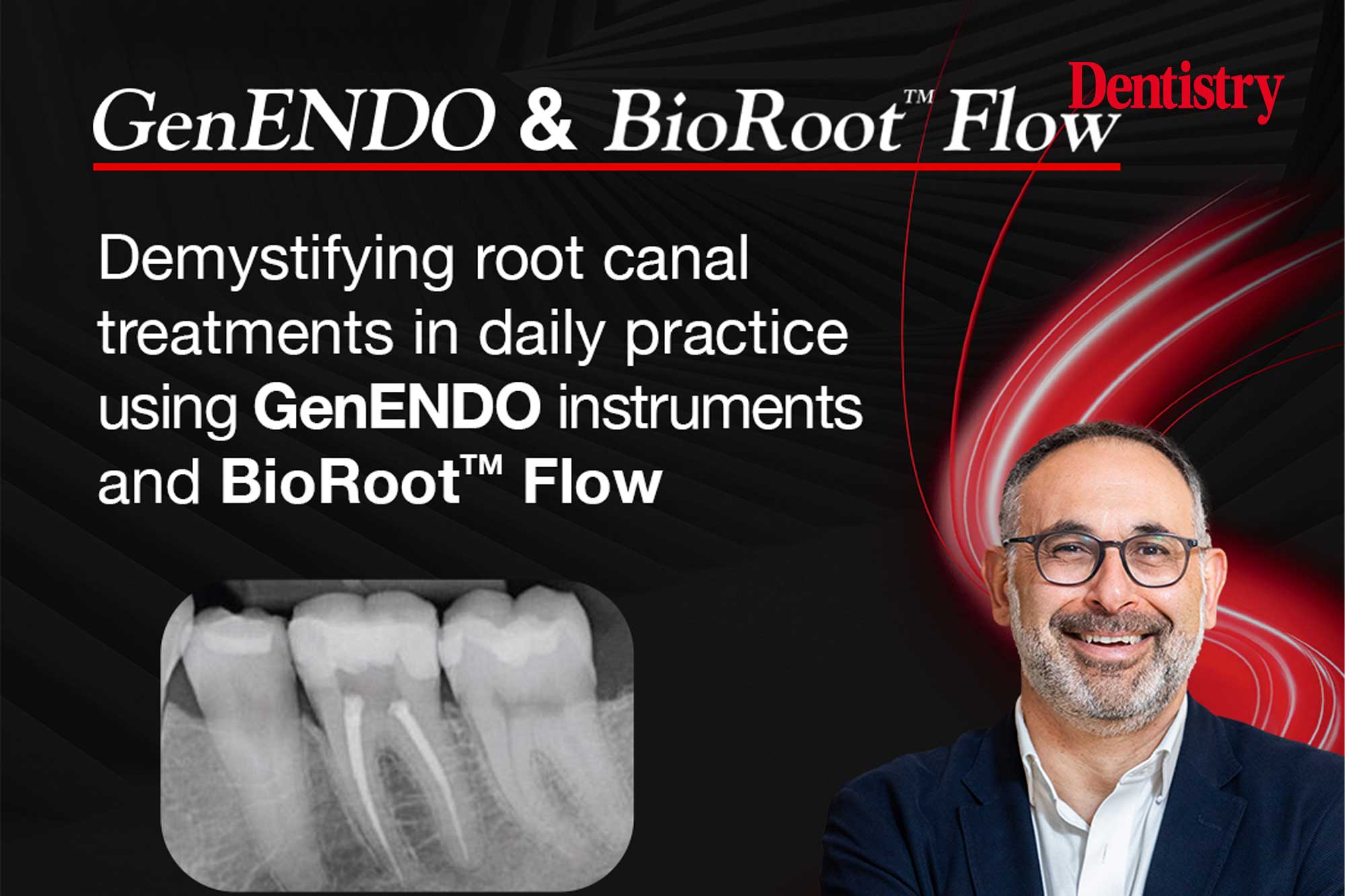 Demystifying root canal treatments in daily practice
