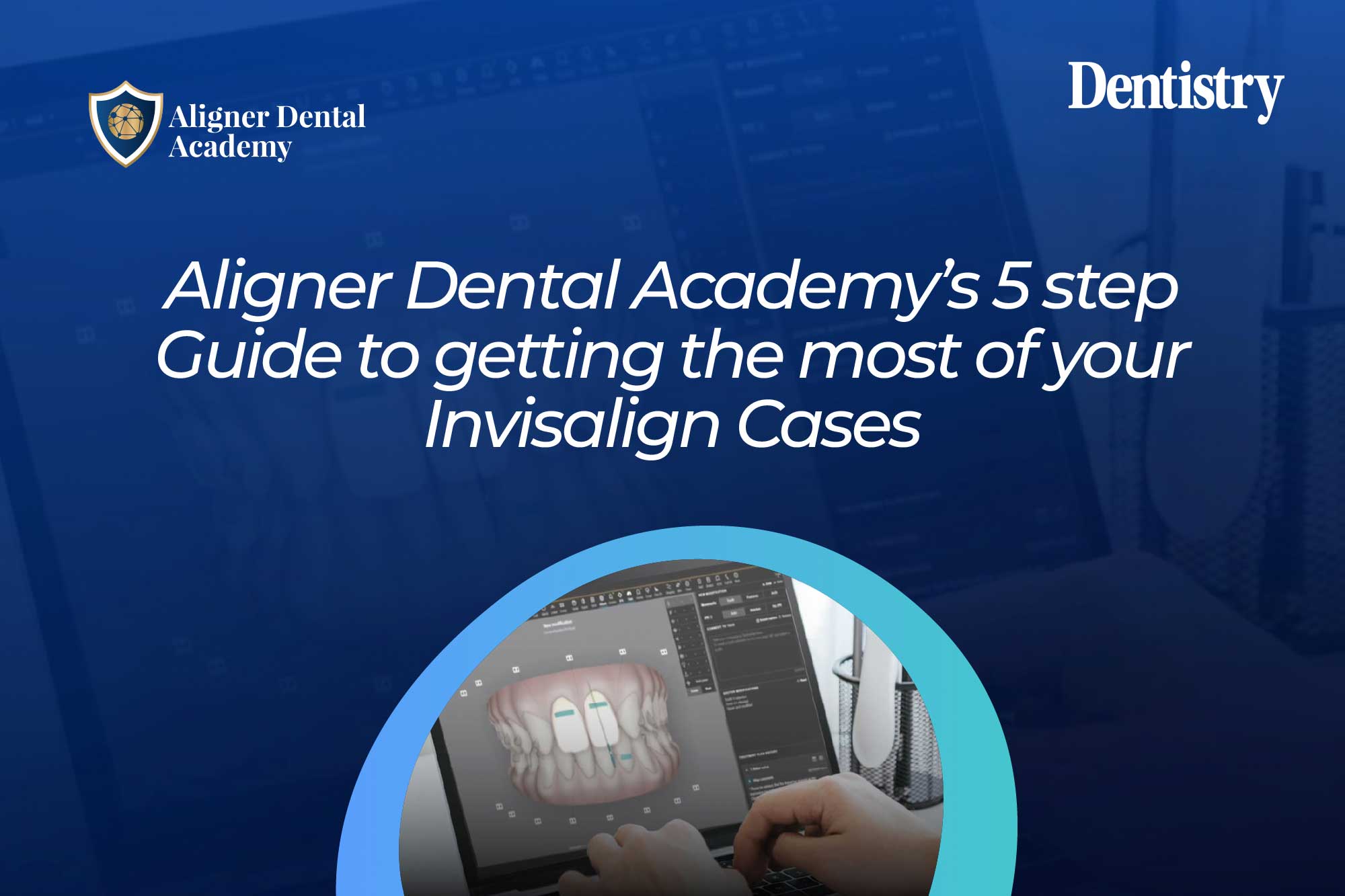 Five steps from ClinCheck confusion to confidence with Invisalign
