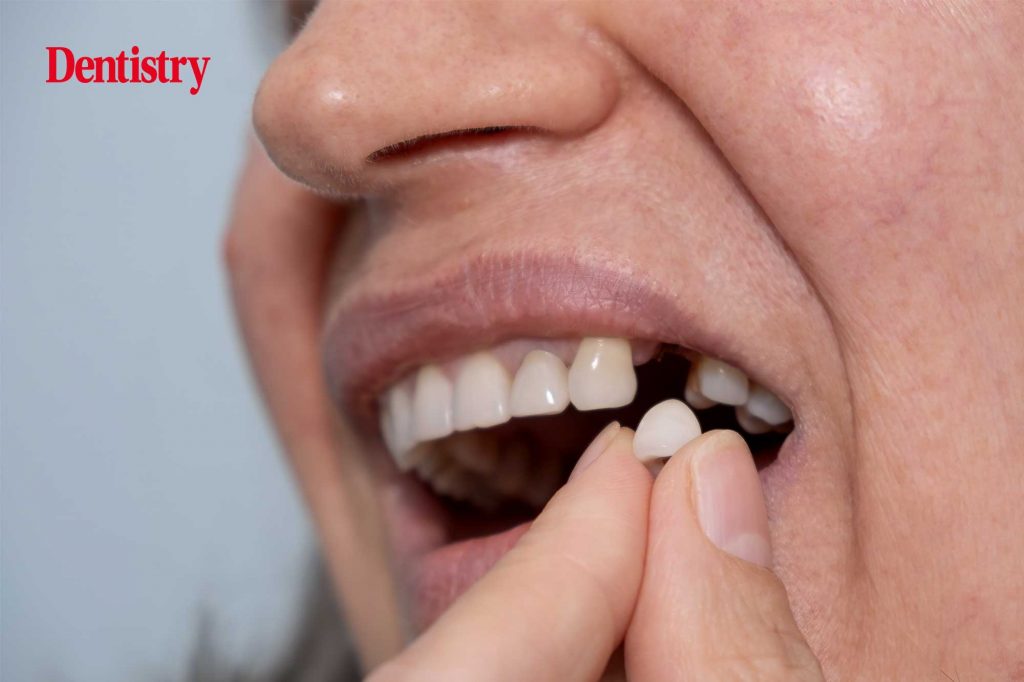 Tooth regrowth experts ready to begin human trial