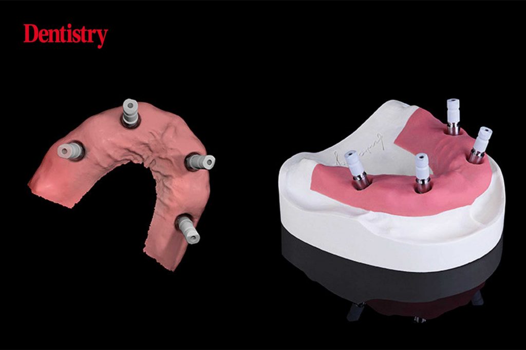 New implant prosthetic components by Zirkonzahn