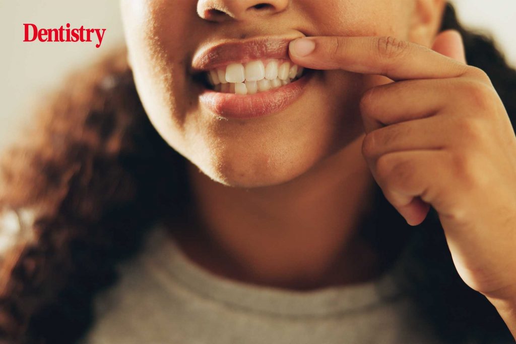 New photoimmunotherapy technique targets periodontitis while preserving good bacteria