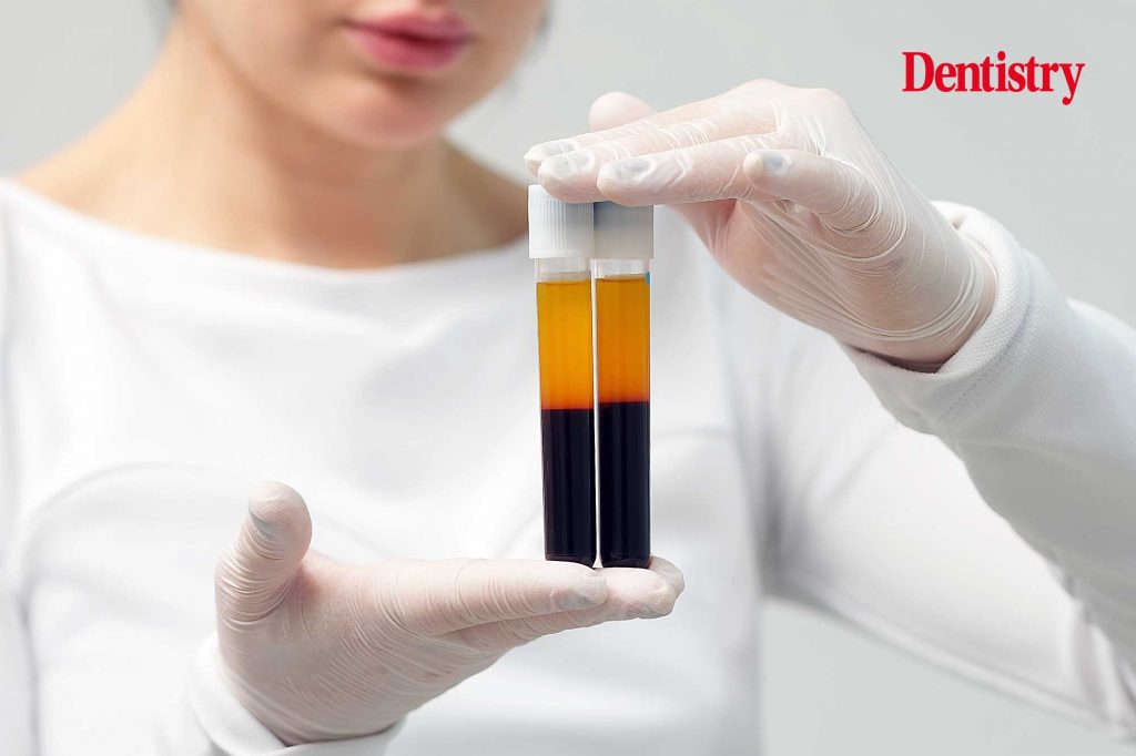 PRF in dentistry: translating platelet-rich fibrin biology into everyday practice