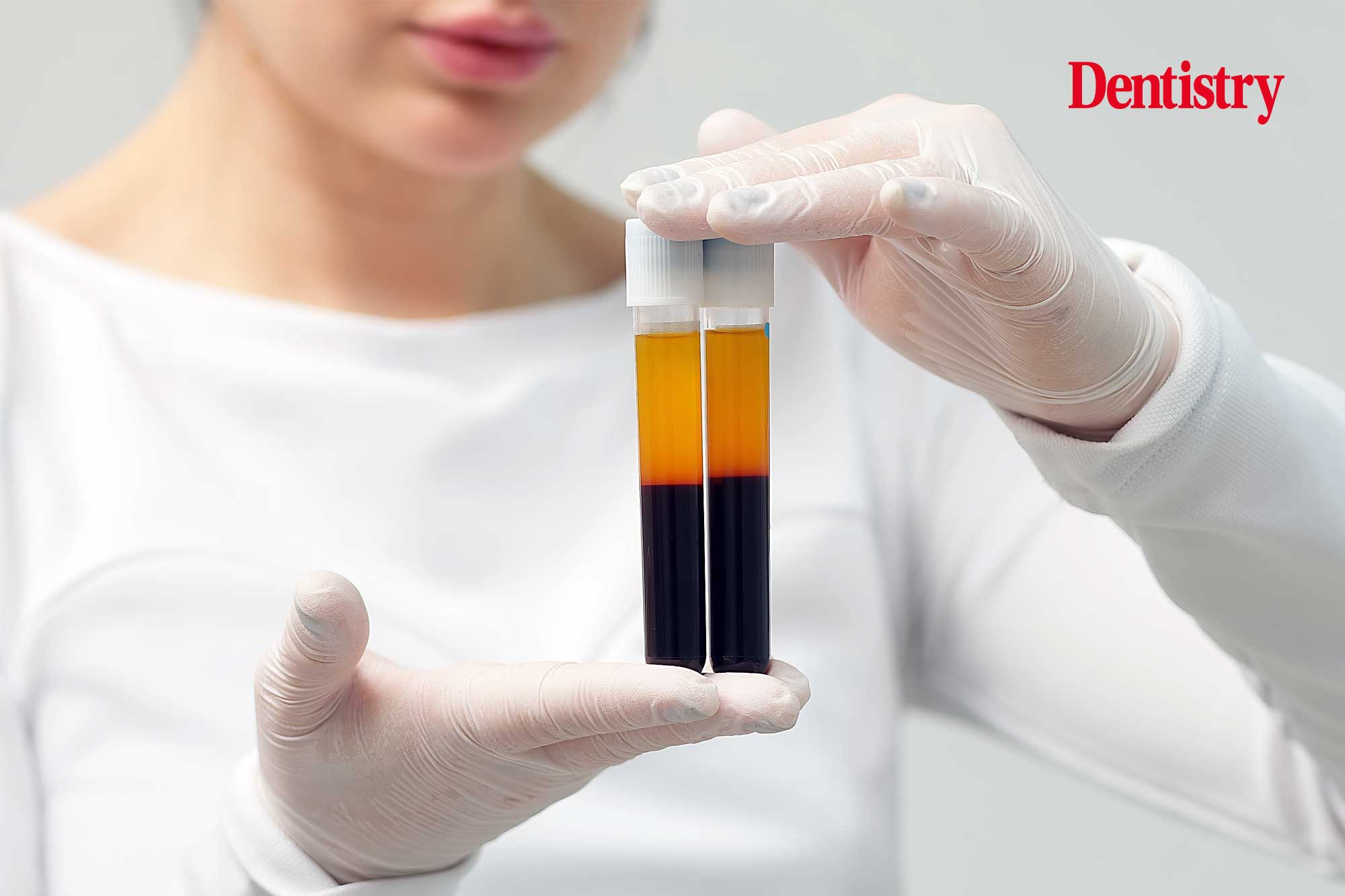 PRF in dentistry: translating platelet-rich fibrin biology into everyday practice