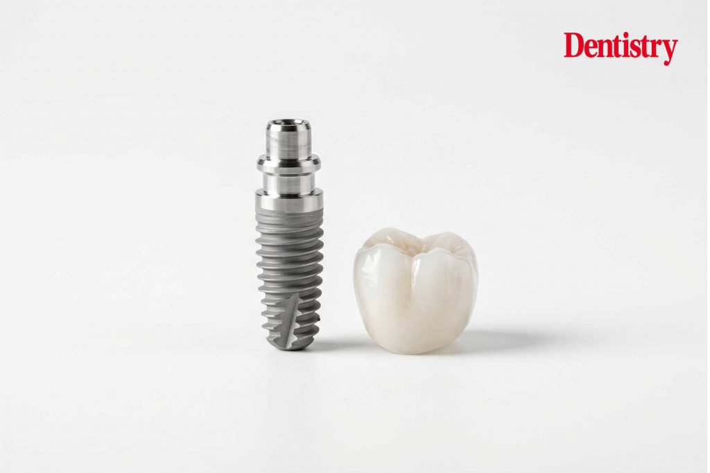 PATZi protocol in atrophic maxillary full arch implant rehabilitations