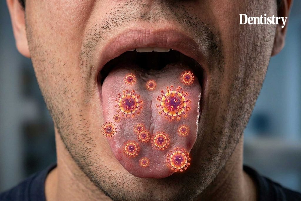 People with long COVID have a 'drastically' different oral microbiome