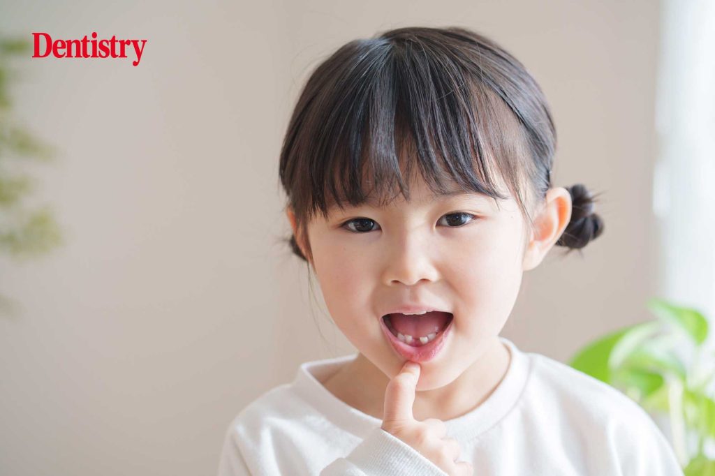 Scottish children have best oral health on record – but disparities remain stark