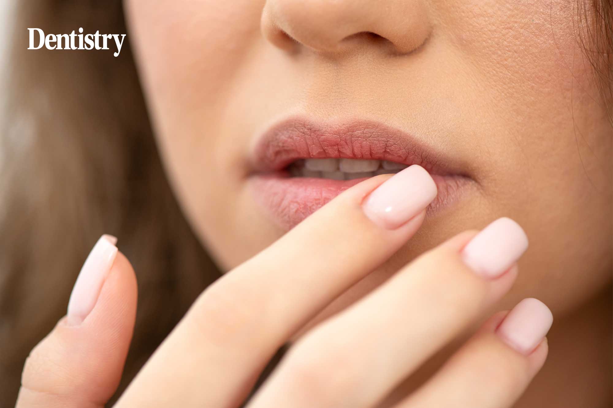 Could stem cells replace damaged salivary glands?