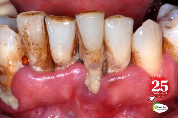 The history of oral health: a 25-year perspective