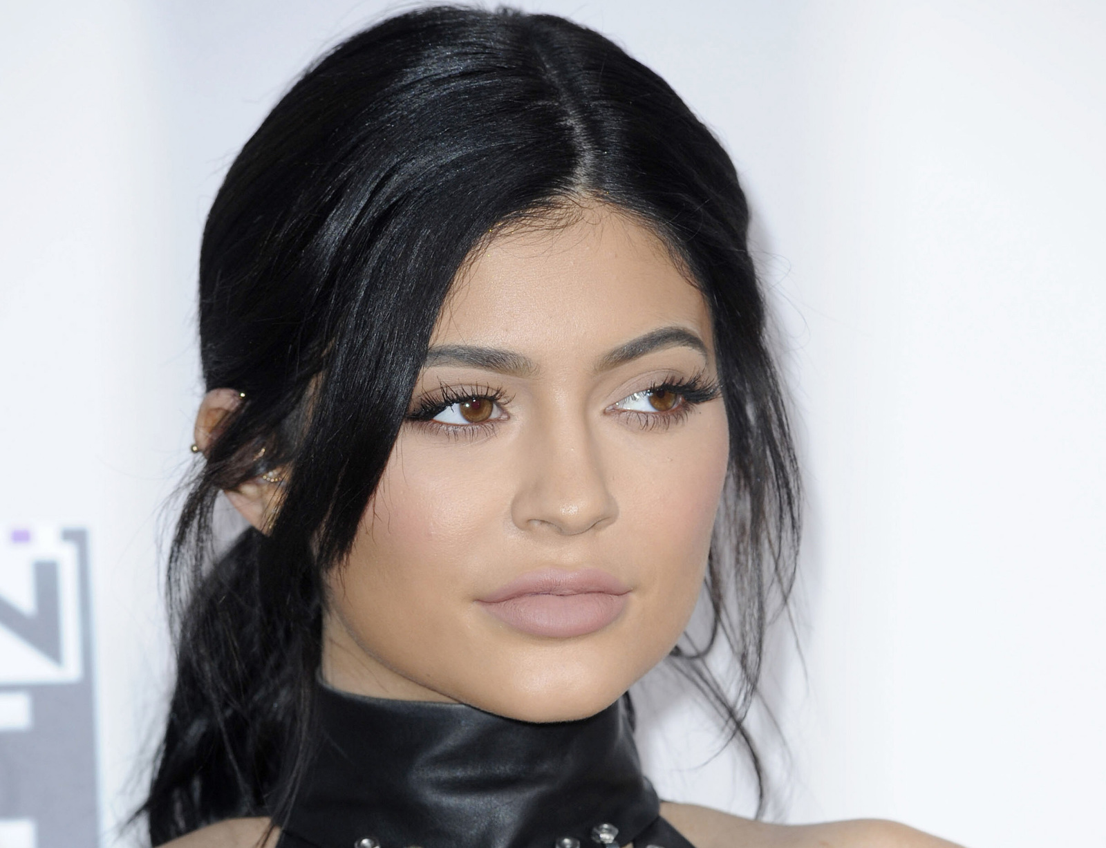 Patient wakes from dental surgery believing she's Kylie Jenner ...