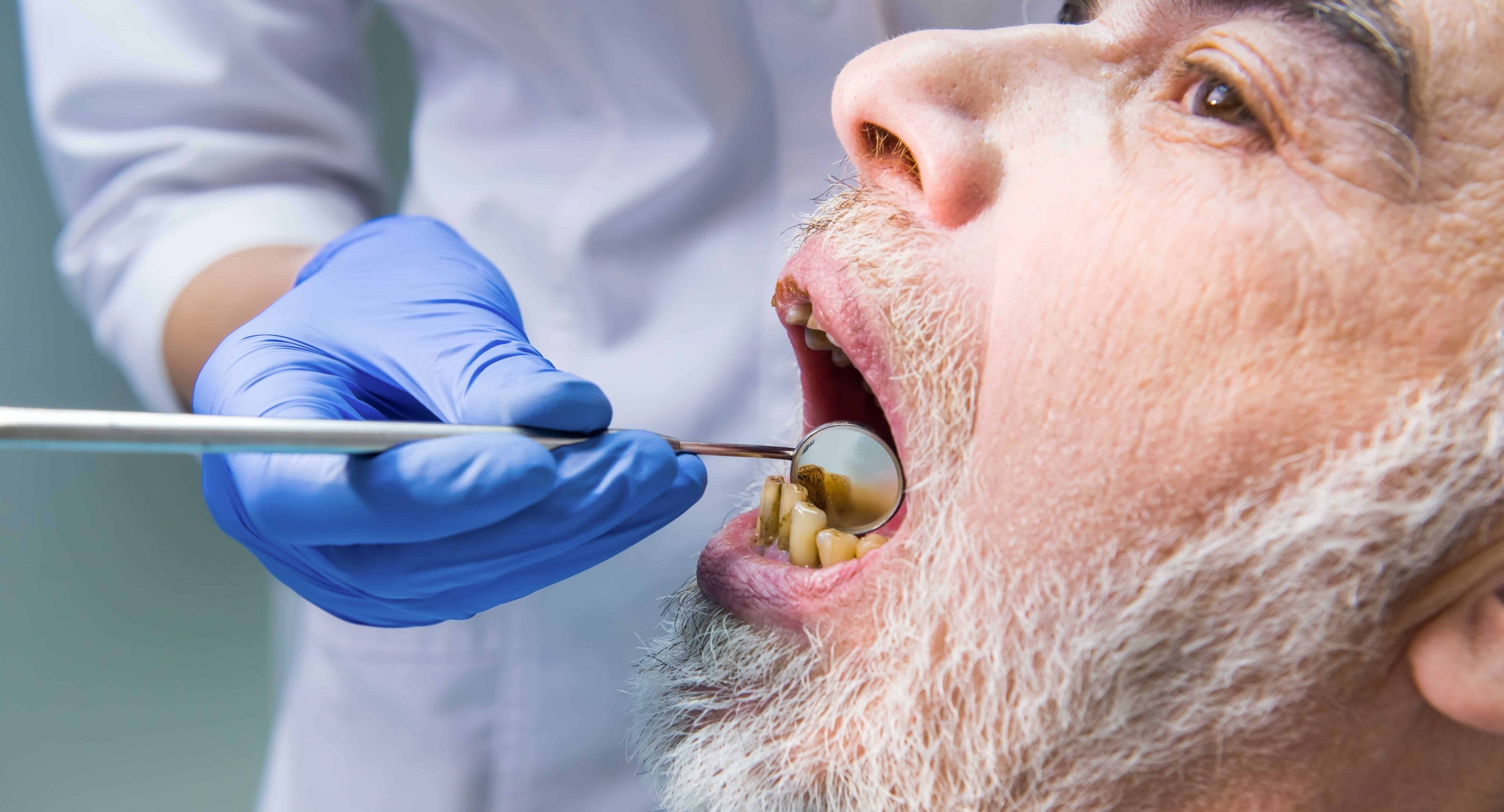 Can Poor Dental Health Make You Sick