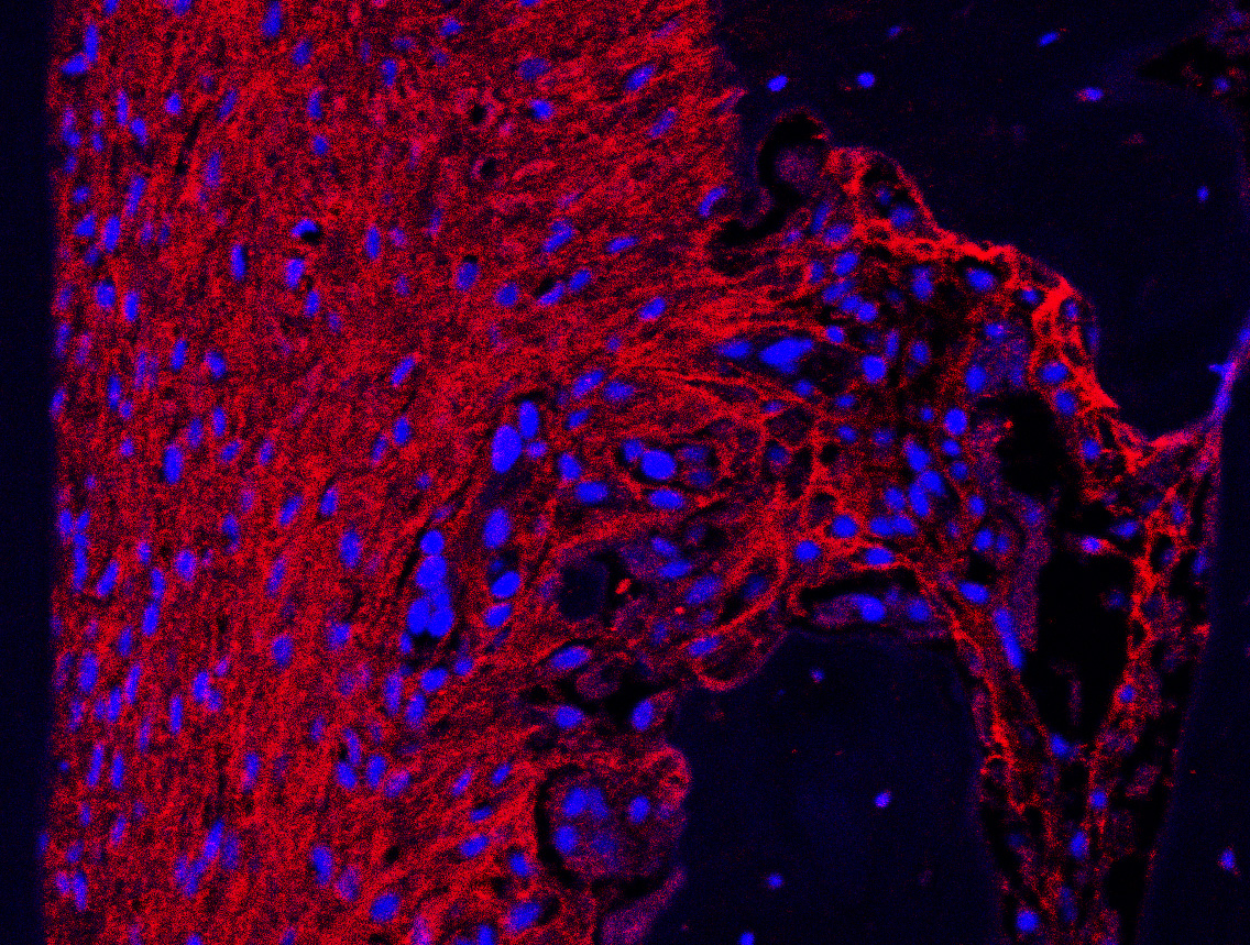 key-new-molecules-uncovered-that-could-help-with-tooth-loss-and