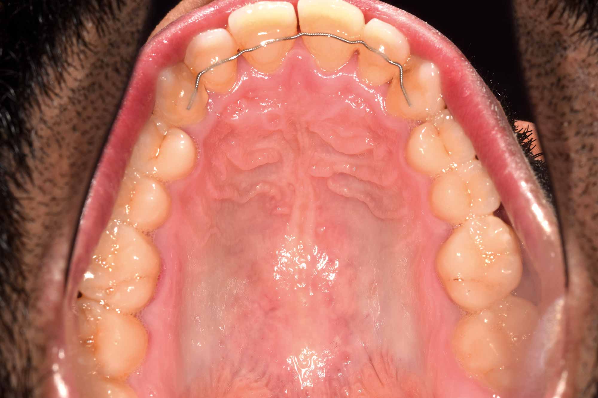 mouth-cancer-20 - Dentistry.co.uk