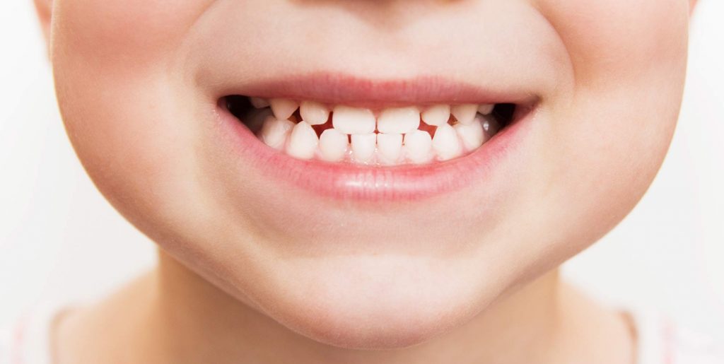 Nearly one in five children say they dislike their smile, new study ...