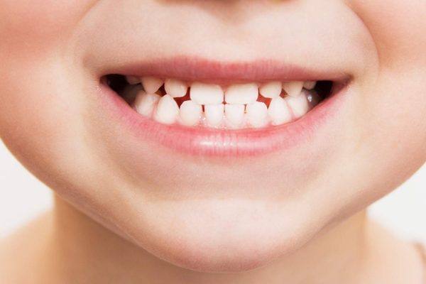 Nearly one in five children say they dislike their smile, new study ...